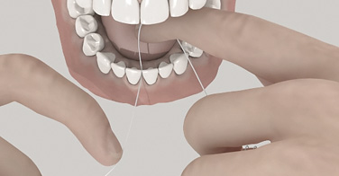 3D - Aufklärungsanimation - Zahnreinigung mit Zahnseide